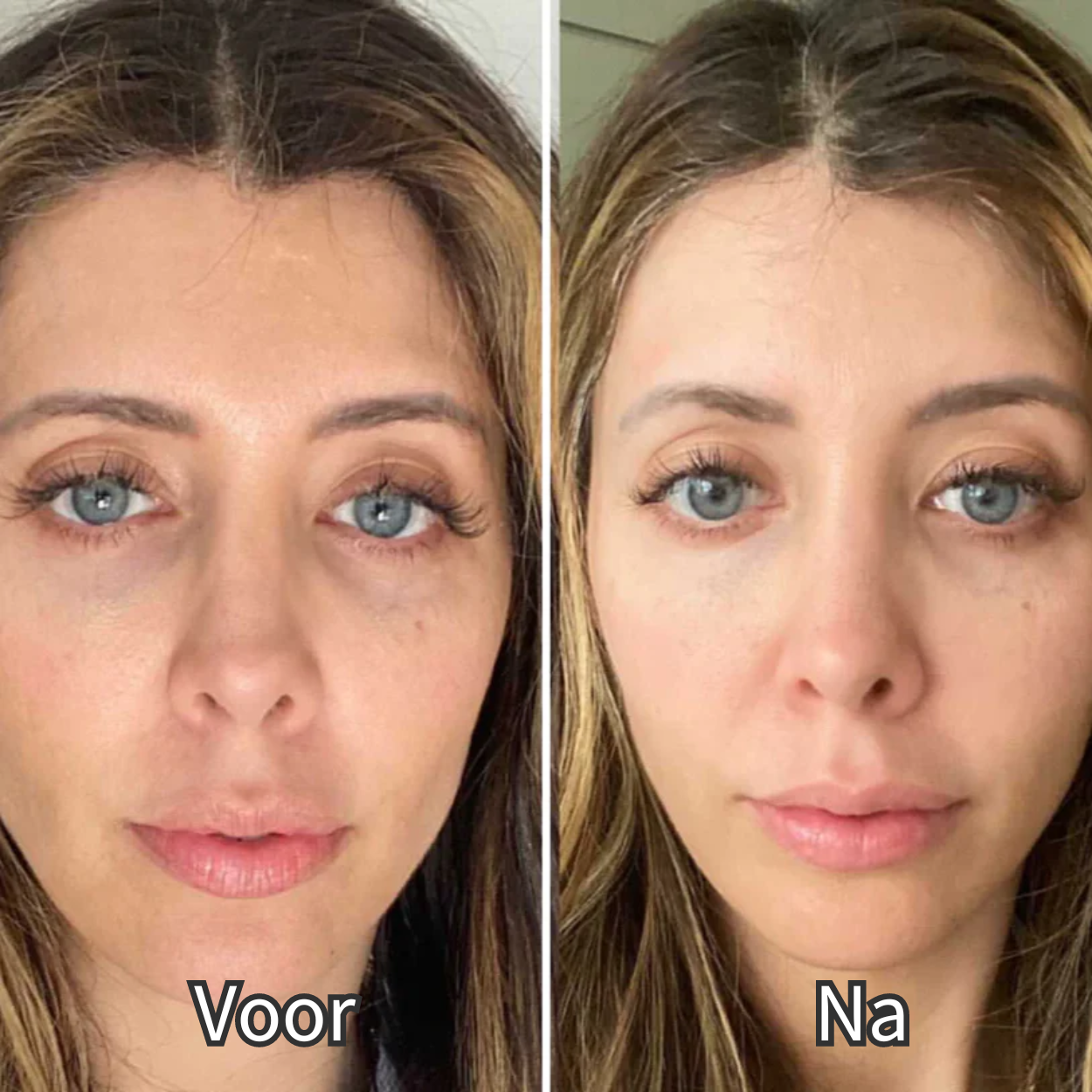 VitalGlow – Gafas de terapia de luz roja para el bienestar y la relajación