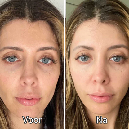 VitalGlow – Gafas de terapia de luz roja para el bienestar y la relajación