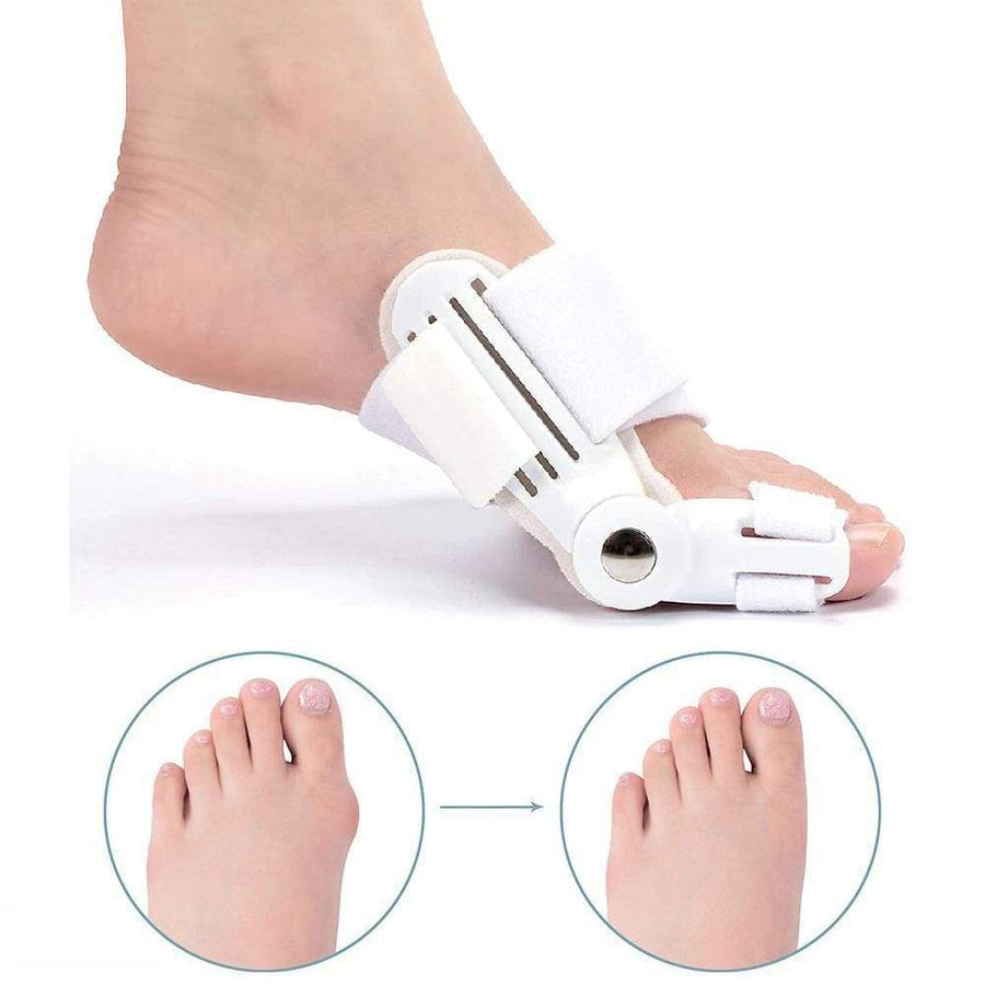 OrthoCorrect potpornik za prste – Korektivno rješenje za Hallux Valgus