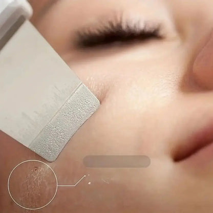 SkinSonic ultrazvučni čistač kože – Za dubinsko čišćenje i svježe pore