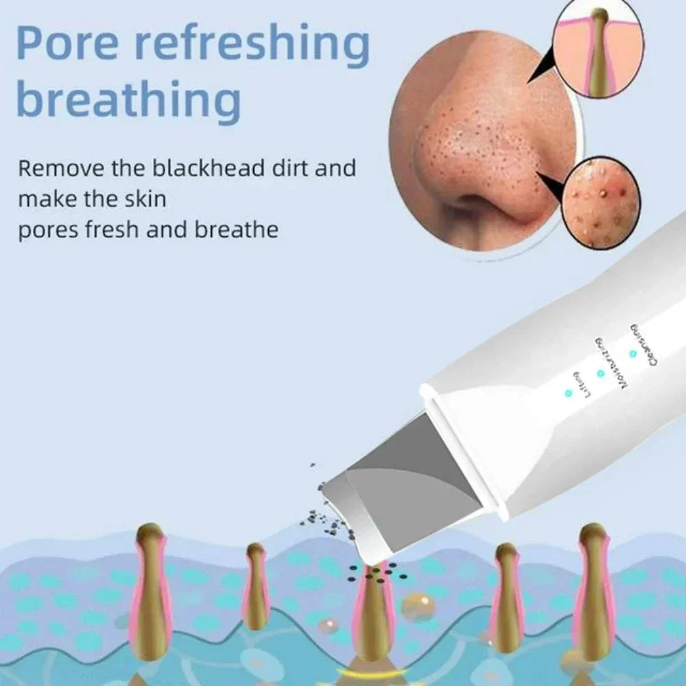 SkinSonic ultrazvučni čistač kože – Za dubinsko čišćenje i svježe pore