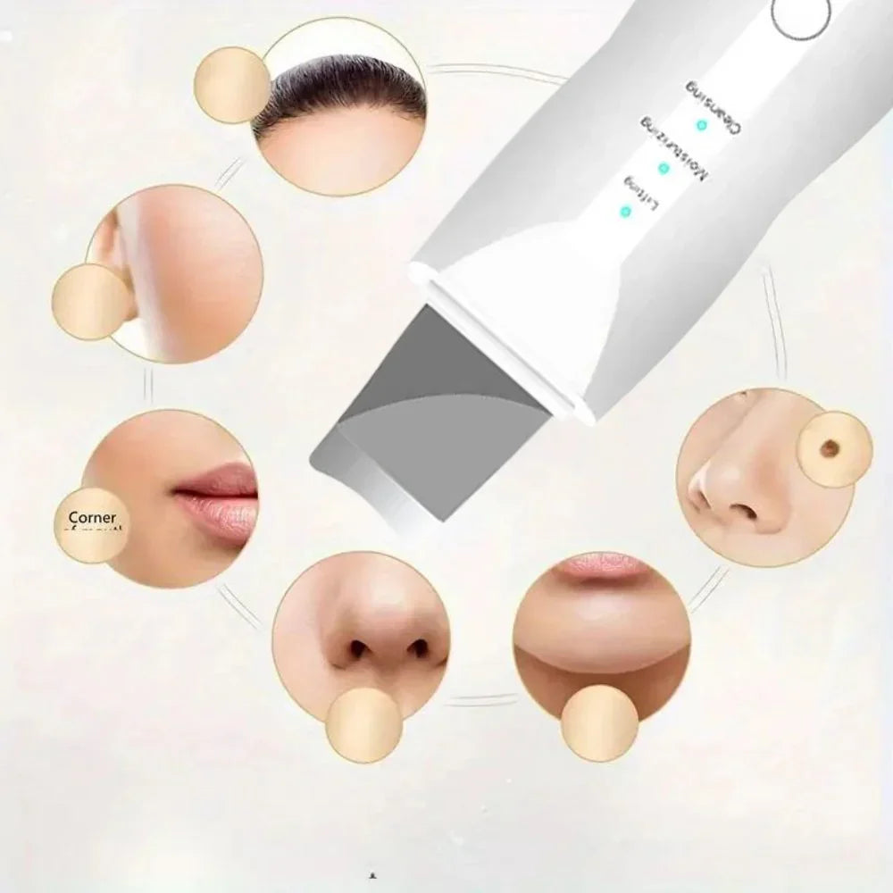 SkinSonic ultrazvučni čistač kože – Za dubinsko čišćenje i svježe pore