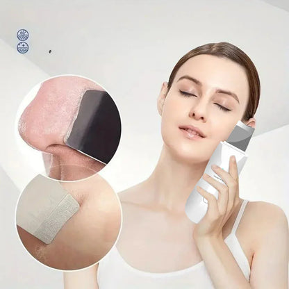 SkinSonic ultrazvučni čistač kože – Za dubinsko čišćenje i svježe pore