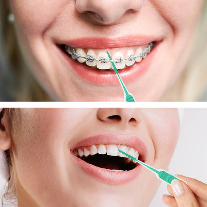 Meki interdentalni čačkalice – Osvježavajuće s okusom mente i ergonomski dizajnirane