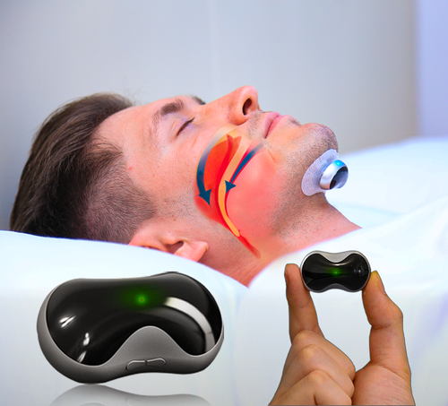 Dispositivo antirronquidos SnoozeFix: mejore su sueño con tecnología cómoda